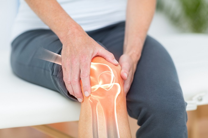 Knee Osteoarthritis